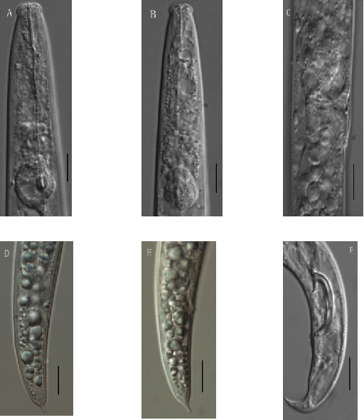 拟松材线虫主要鉴定特征:雌虫尾端有尾尖突(大于3μm),幼虫尾端有尾尖
