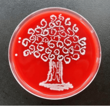 腐生葡萄球菌血平板图片
