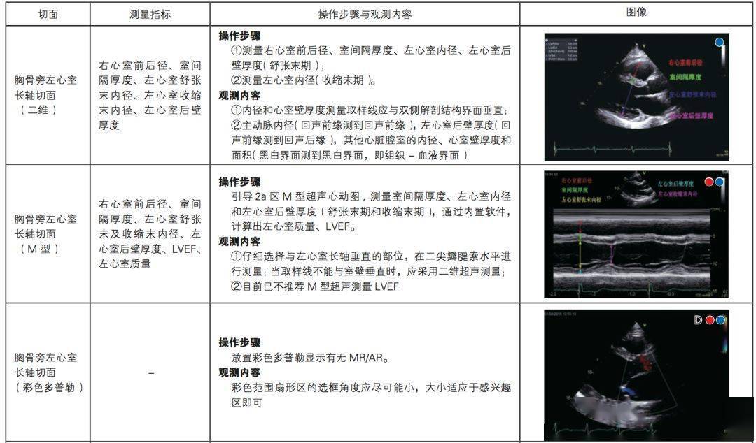 中国成人心力衰竭超声心动图规范化检查专家共识