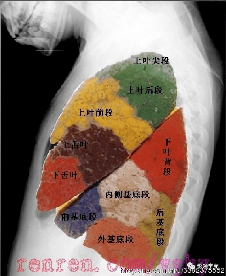 右肺上叶后段位置图图片