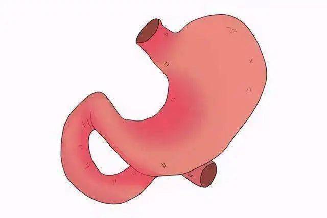 医识发现胃息肉这是病变的信号吗