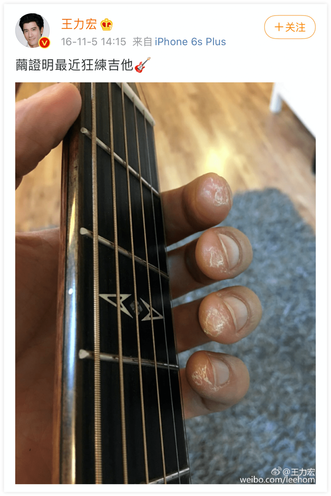 为了练吉他,手指磨出厚厚的茧子,这就是他努力的证明