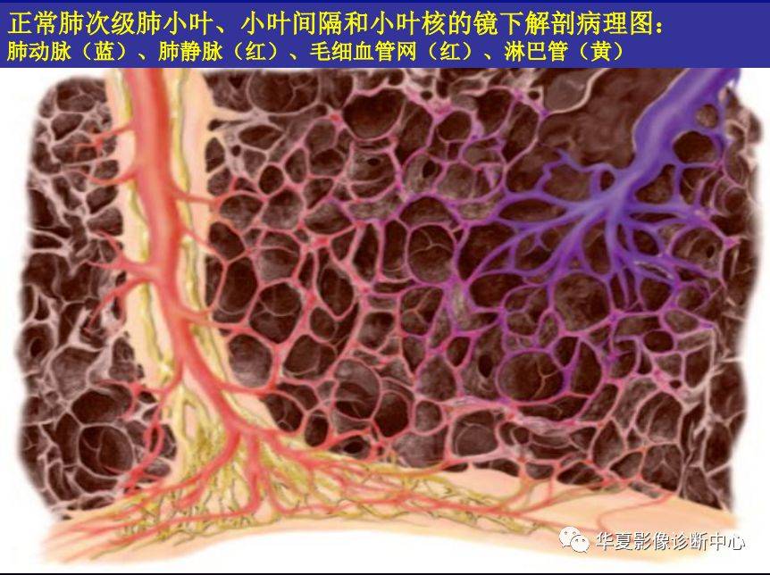 肺间质性疾病的解剖