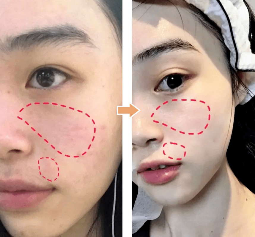 女明星的牛奶肌原来都是靠它