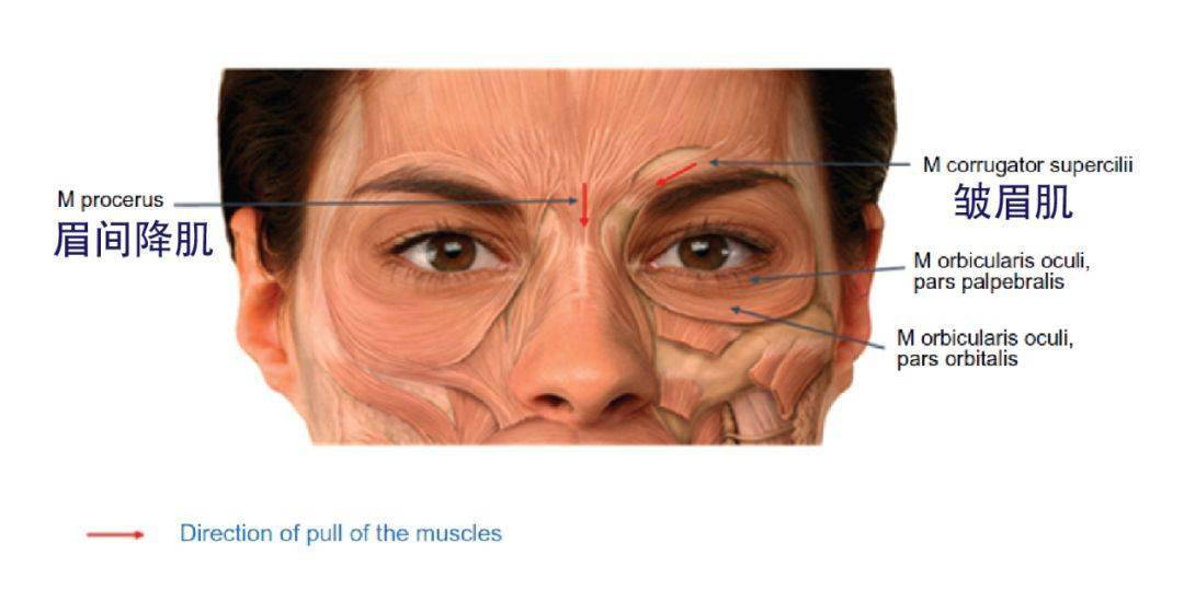 降眉肌位置图片
