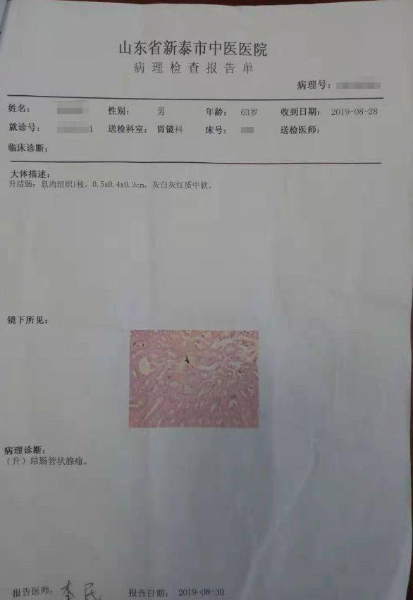 又过了两天病理结果出来了,是(升)结肠管状腺瘤.