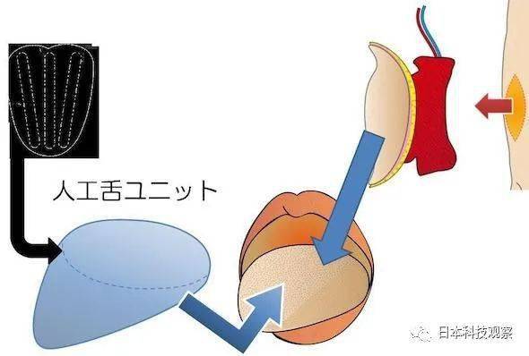 完全可植入的具有吞咽功能的人造舌介绍_舌头