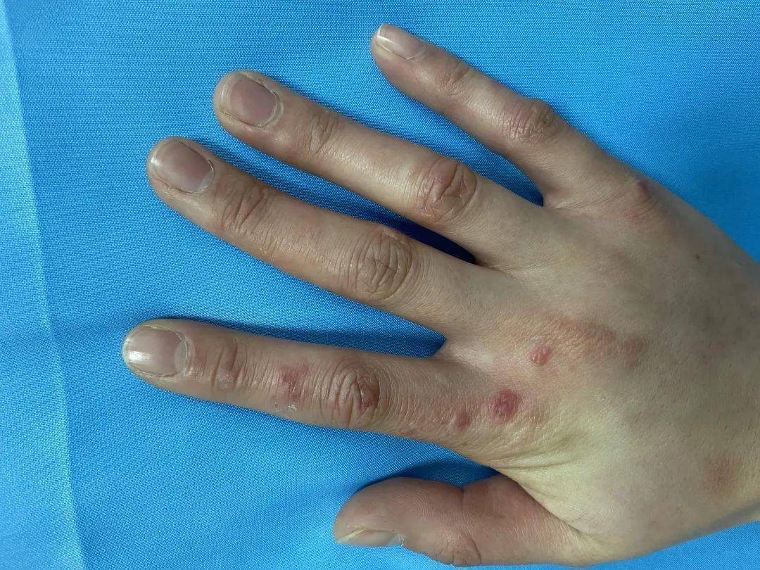 又痛又痒小时候常长的大萝卜到底是怎么回事