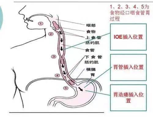 【喜讯】平度市第三人民医院康复科成功开展ioe技术