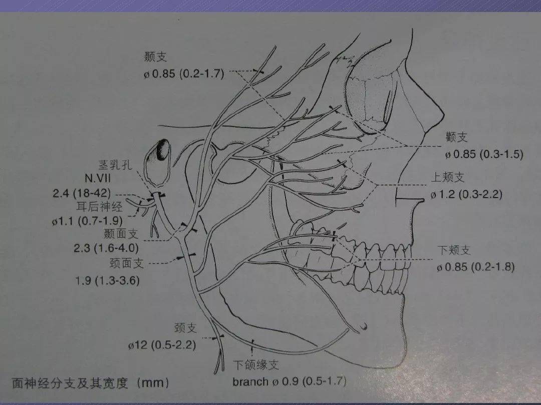 pterion翼点解剖及入路