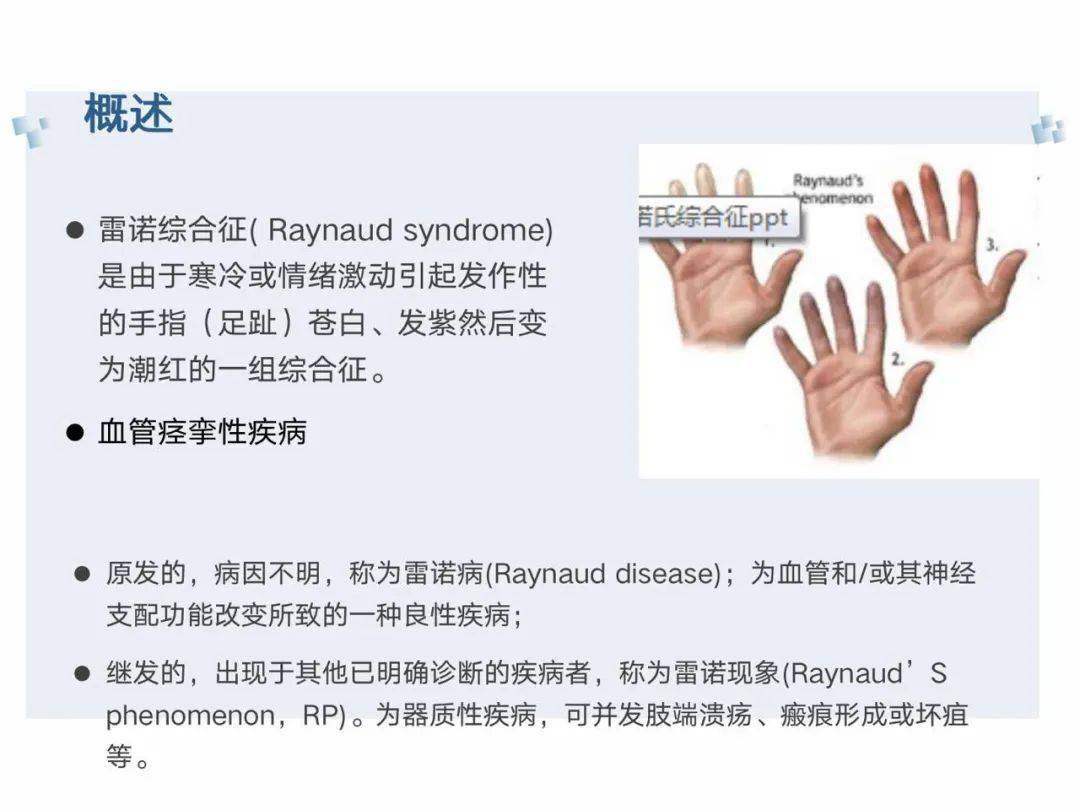 雷诺病PPT图片