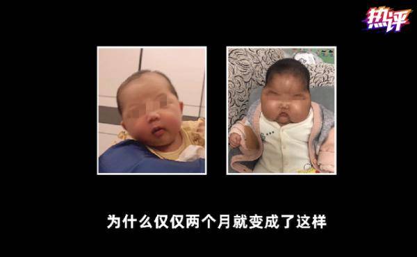 湿疹激素药强度排行_湿疹不可长期服用激素类药物(2)