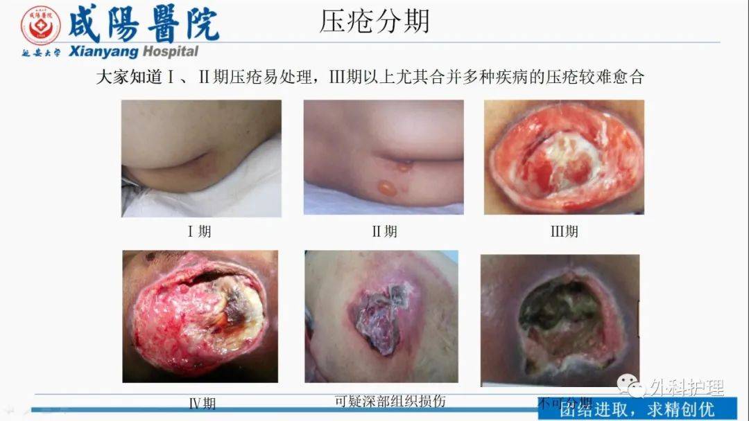 Ppt 一例开颅术后病人压疮的护理案例分享 组织