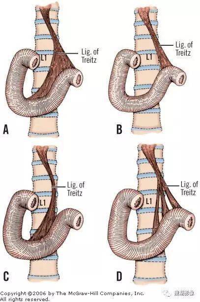 屈氏韧带的解剖位置图片