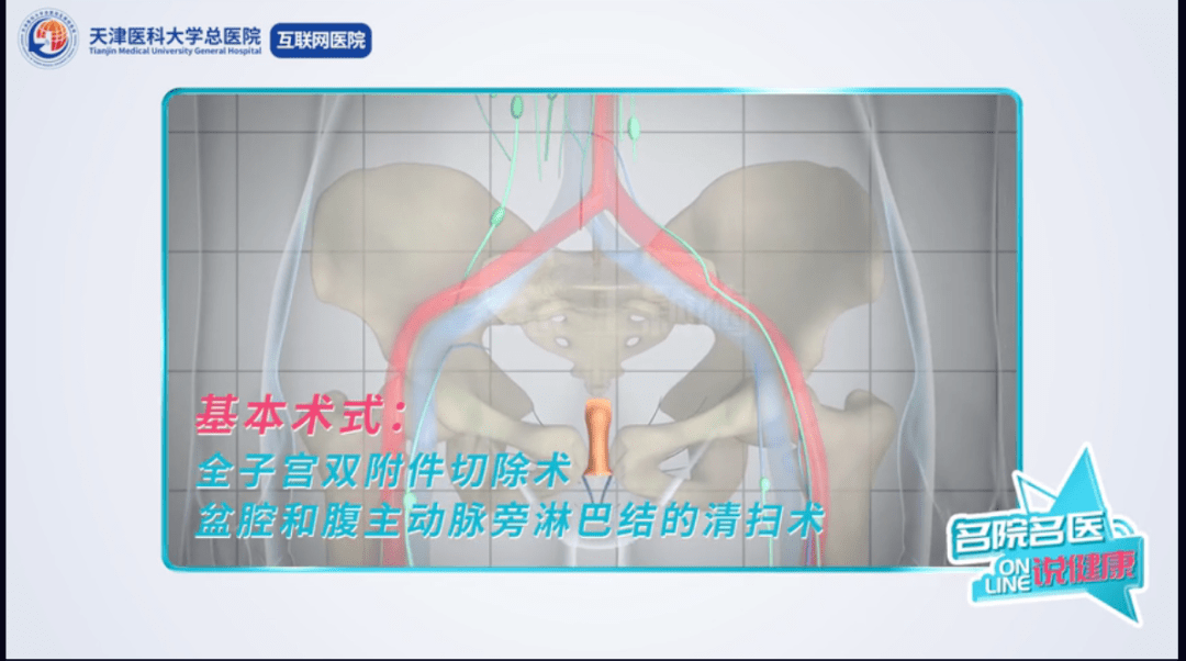 互聯網醫院說健康月經紊亂絕經後陰道出血小心子宮內膜癌婦產科王穎梅