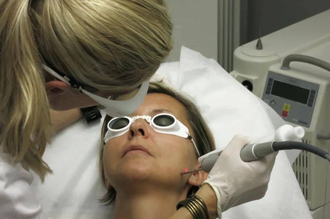 医美分享我的fotona4d的初体验