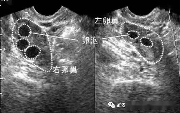 计算排卵期你会几招