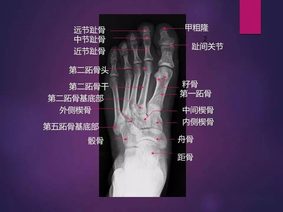 收藏必备 | 全身骨肌系统正常影像解剖(高清图谱)