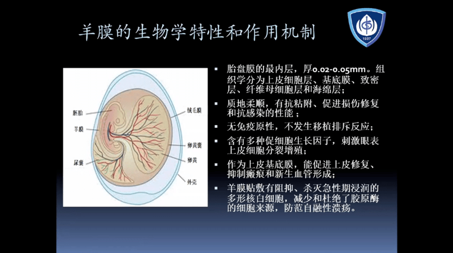 羊膜移植图片