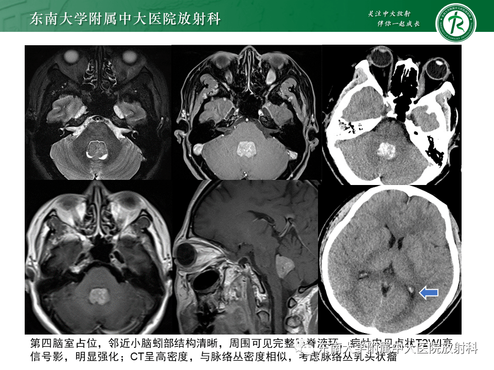 b960bb72ddac44d1a10ee34911ac98d3.png
