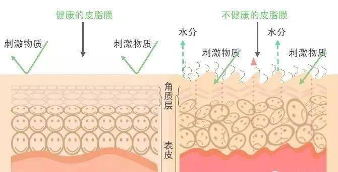 认识皮肤了解皮肤屏障皮脂膜