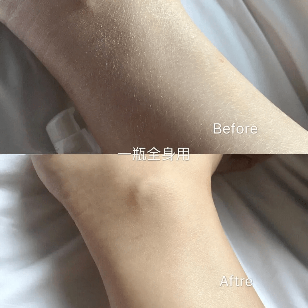 晚上睡觉全身痒抹要身体乳(涂身体乳身体有点痒怎么回事)