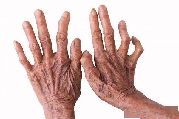 世界防治麻风病日全面消除麻风危害共同走向文明进步