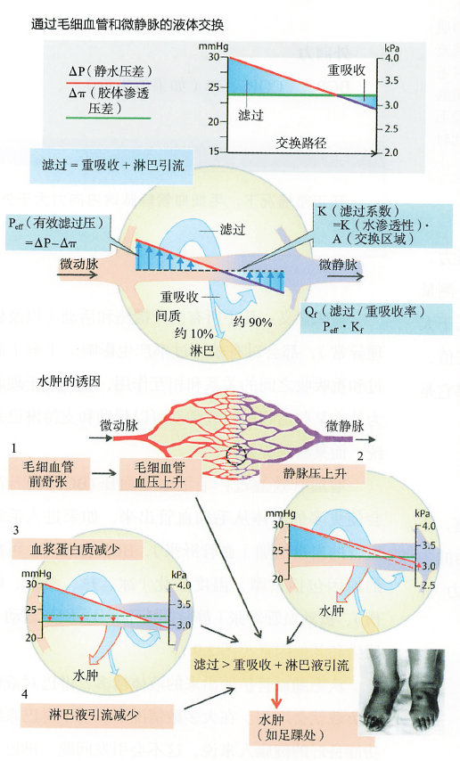 淋巴水肿的诱发因素_患者