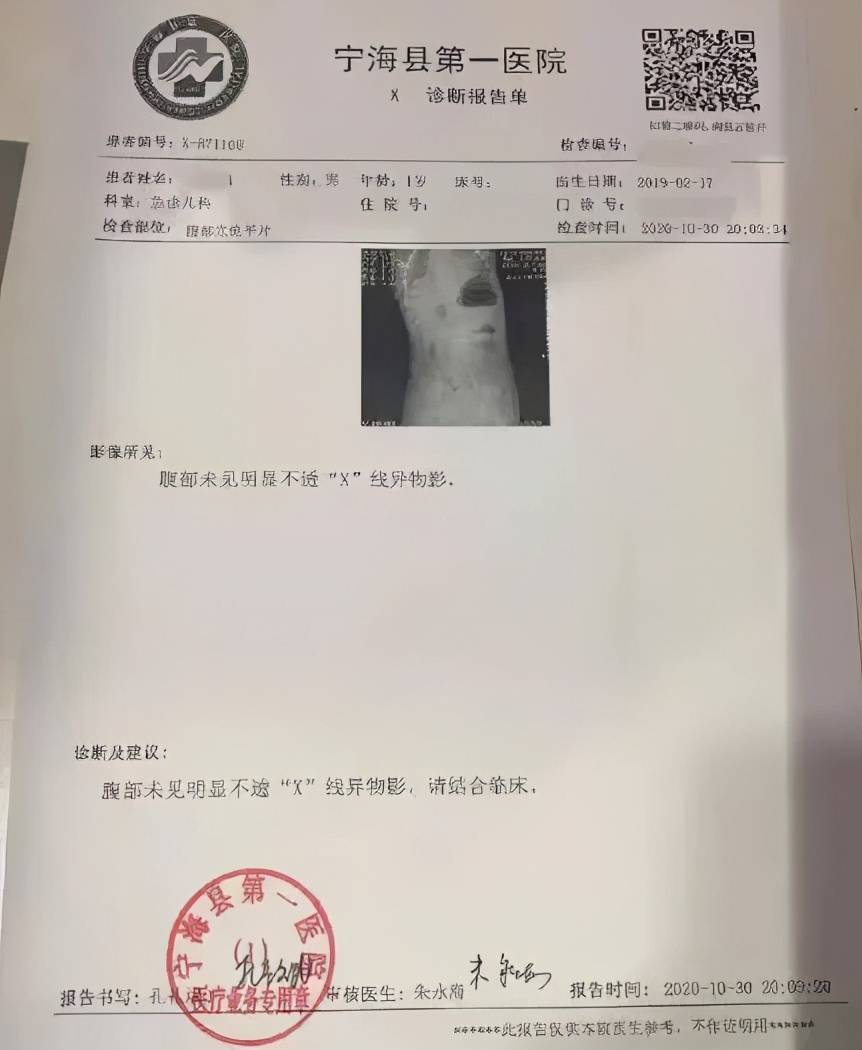 1歲寶寶突然吐血嘴唇變藍4天后死亡兇器藏在每一個孩子身邊