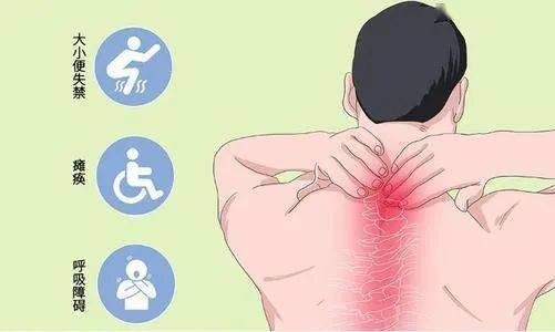 「科普」脊髓损伤的康复