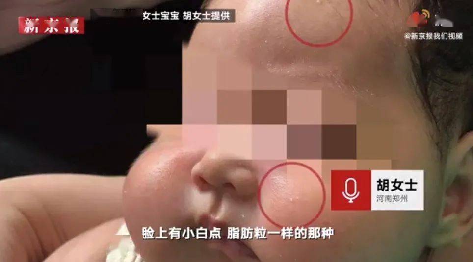 时隔一个月婴儿霜又出事激素严重超标却有无数孩子在用