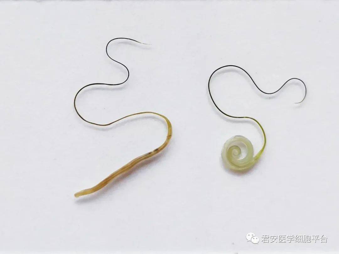 雄性,雌性鞭虫重叠管型橙色血质结晶雄性鞭虫松花粉人虱红细胞吞噬