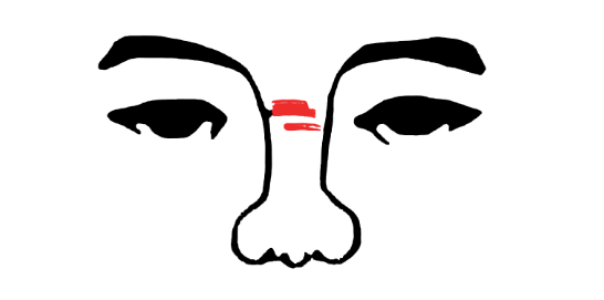 鼻褶心征示意图图片