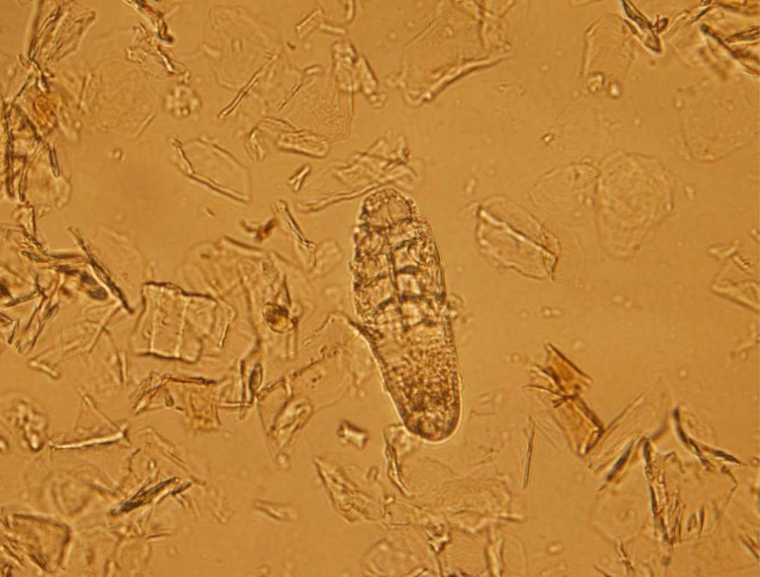 接诊过上千例瘙痒病例,这位皮肤病专家这样剖析瘙痒的病因,诊断与治疗