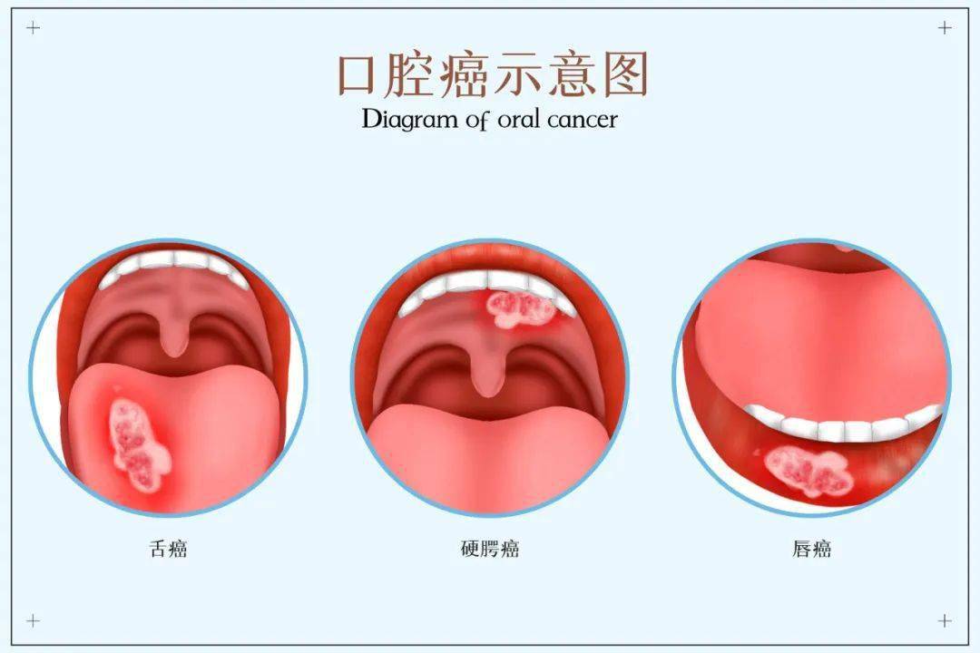 60岁老人口臭怎么办_口臭怎么办