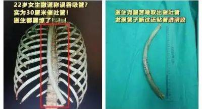 管子|呕！这种“仙女管”，你也敢往嘴里插？会要命的！