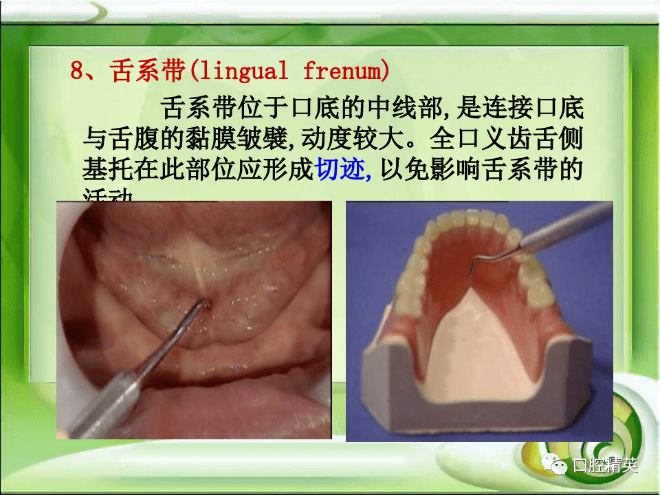 全口无牙颌解剖标志识别