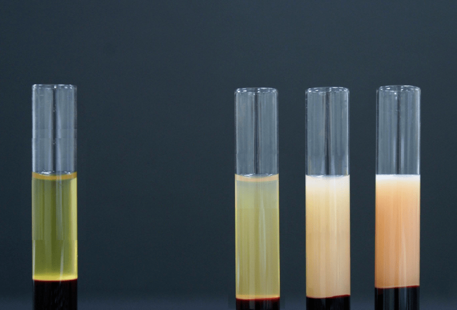 32岁高血脂男子喝了一碗骨汤后突发胰腺炎抽血竟一半是油