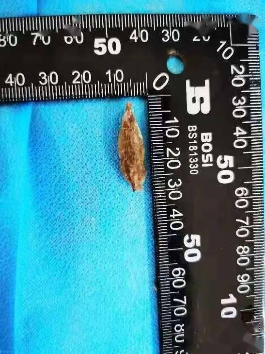 过年期间生命大救援咸阳民警搜山救出走失坠井老人陕西多人枣核卡食道