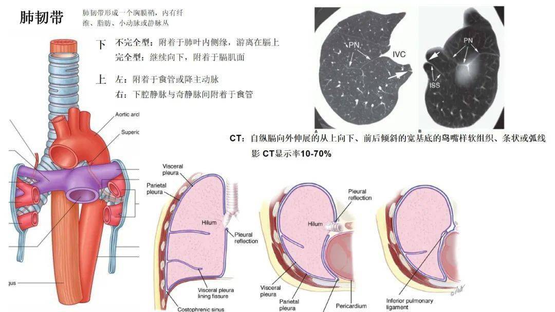 右肺叶间裂示意图图片