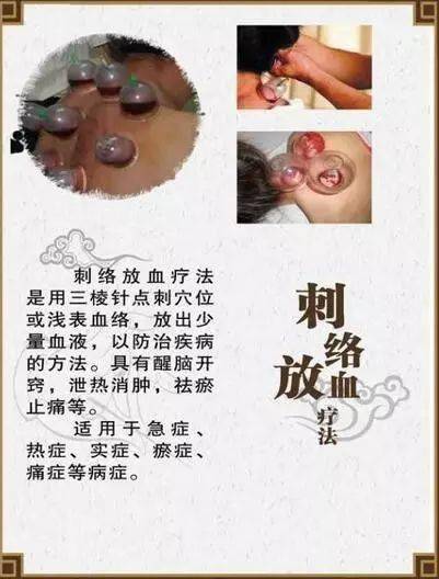 刺络放血疗法,是中医学中的一种独特的针刺治疗方法是《内经》时