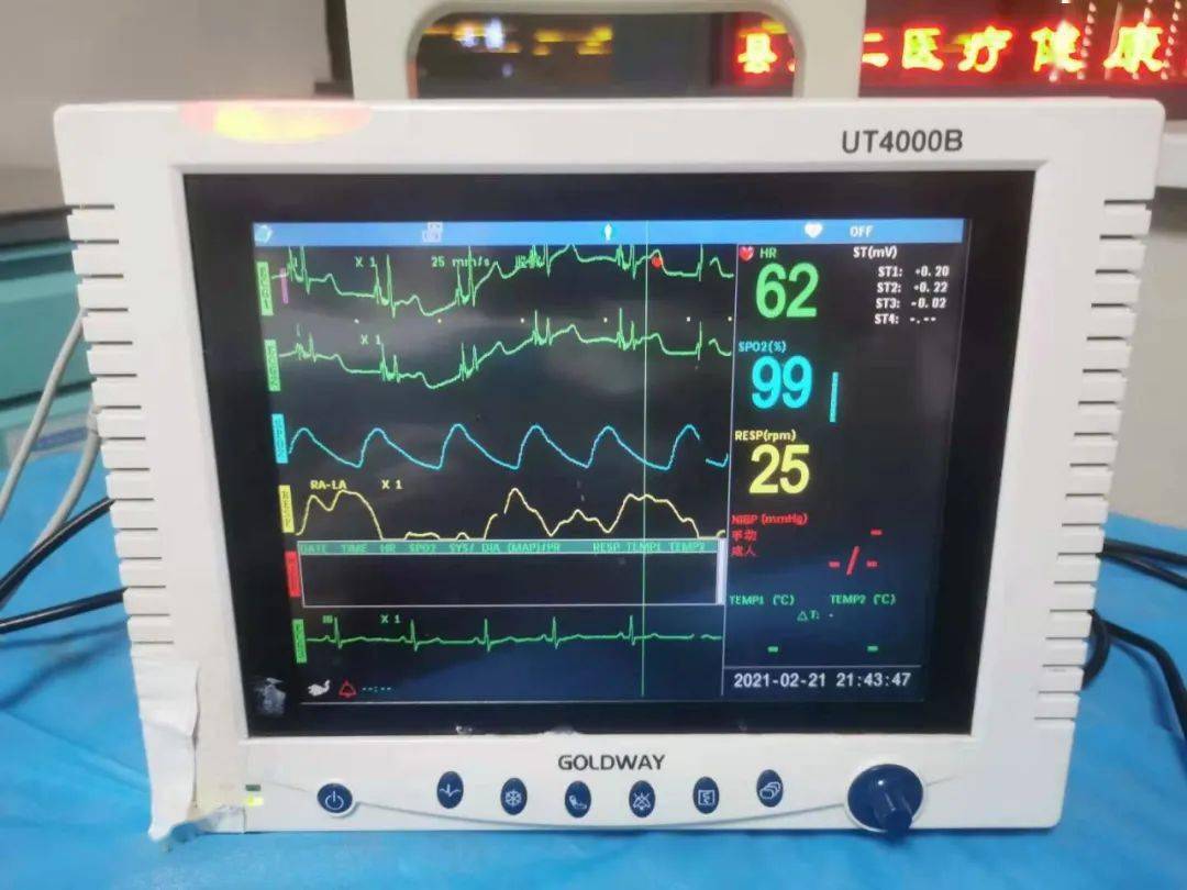 鄲城縣第二醫健集團縣中醫院成功開展picc置管心電腔內ecg定位技術