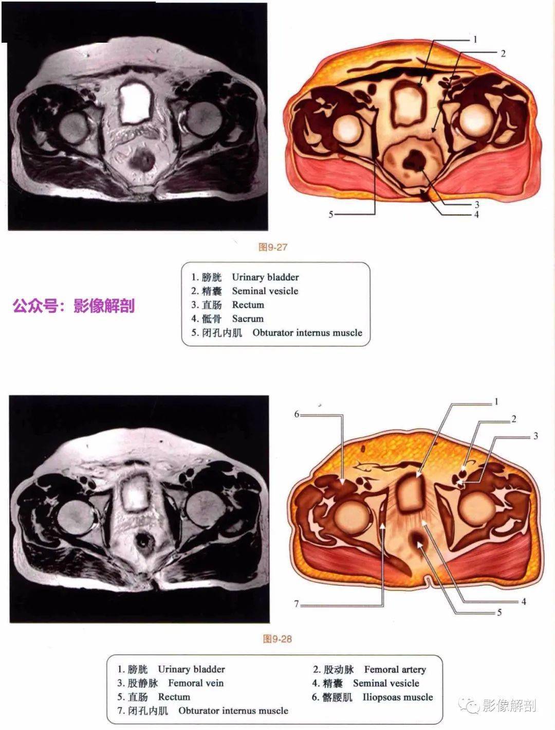 斷層圖譜 | 男,女性盆腔解剖圖譜