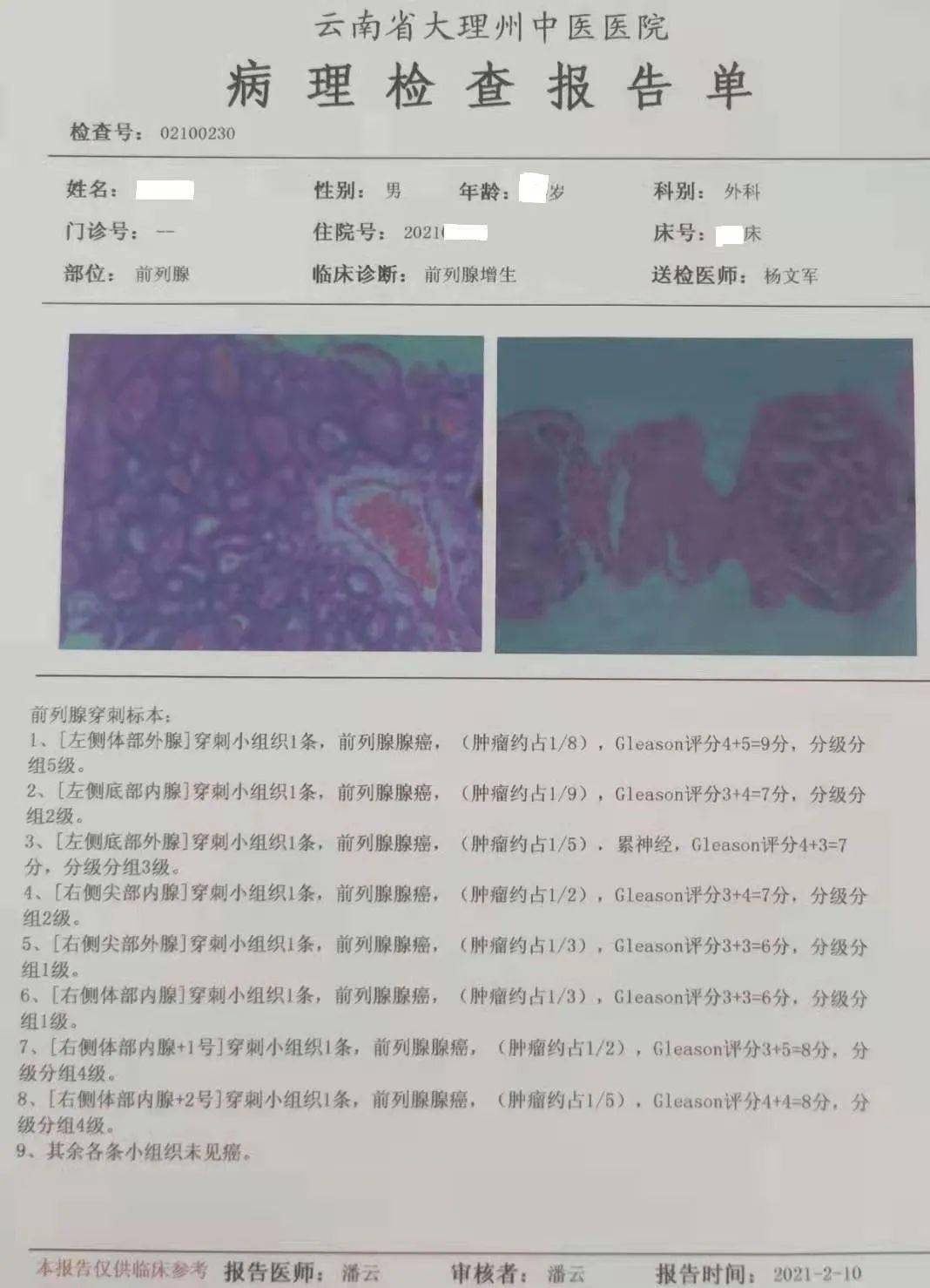 活检报告几天出结果图片