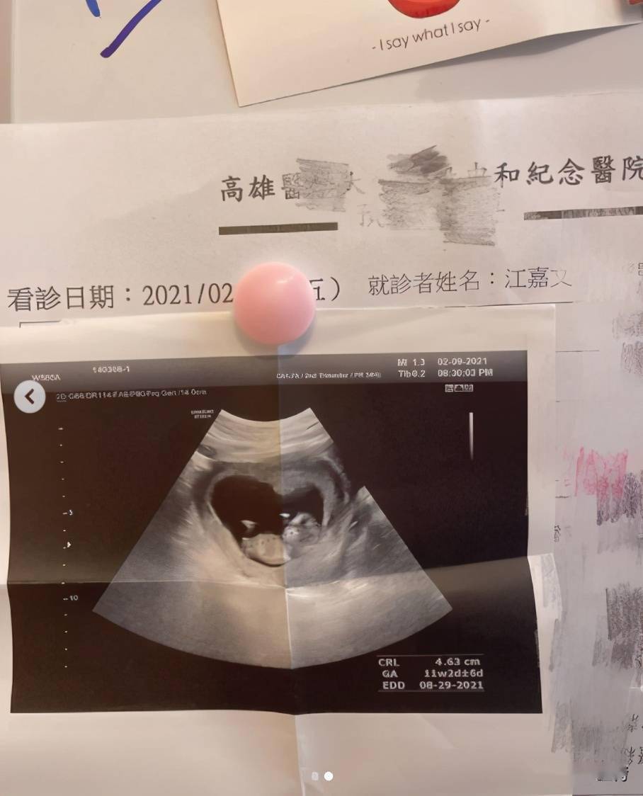 怀孕初期b超图片 男孩图片