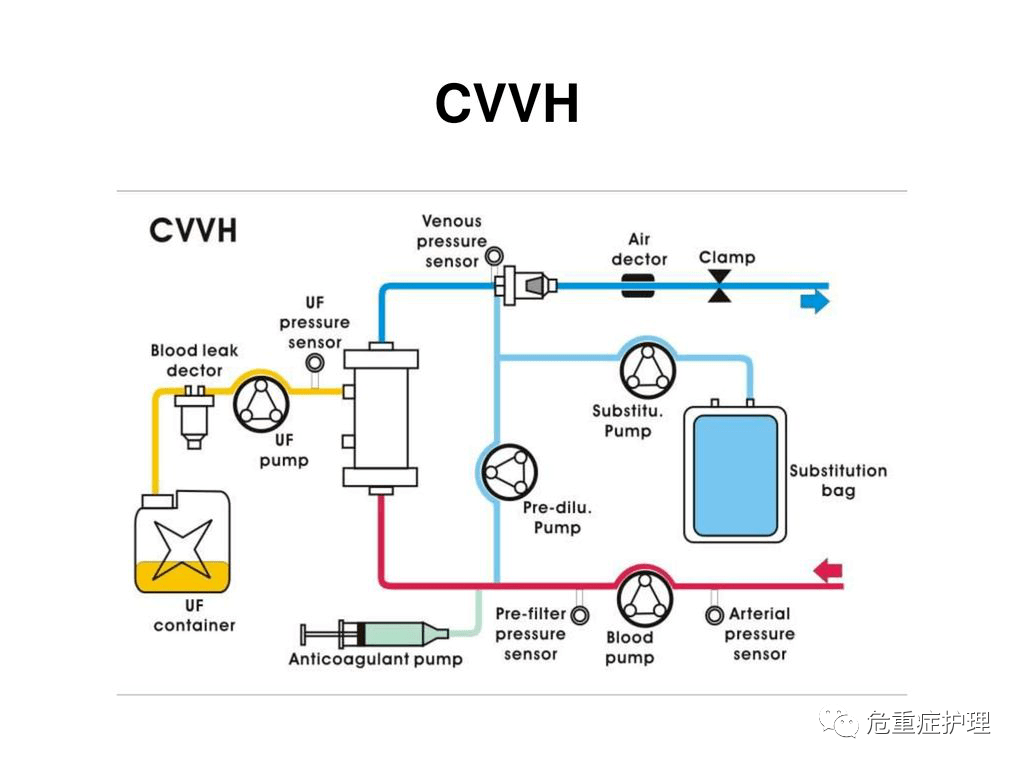 crrt总脱水量显示为负数你见过吗