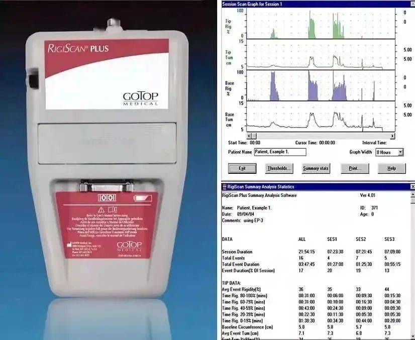 近日,男性勃起功能检测的客观10定量测量仪器----rigiscan阴茎硬度