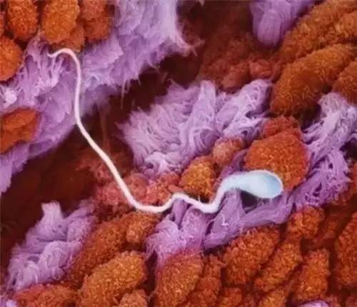 精子进入女人体内的全过程（动图），太震撼了…