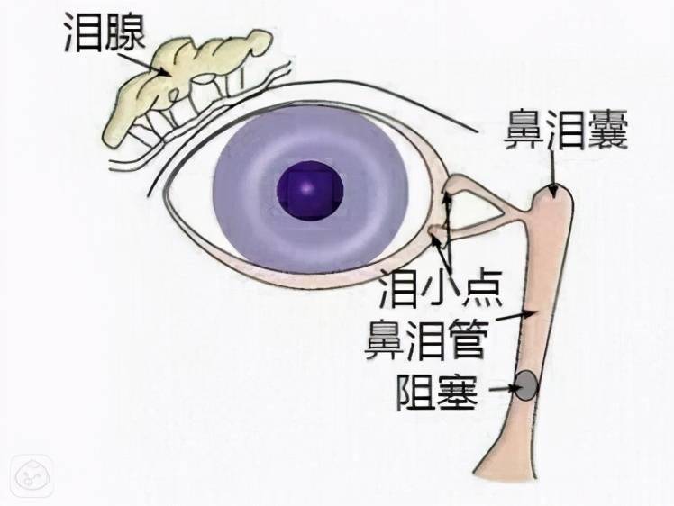 泪道按摩有什么用，要怎么操作？_阻塞