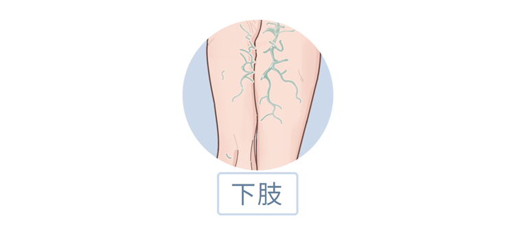 身上4个部位的青筋凸起,或是身体在"报警",及时检查_静脉